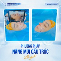 Nâng mũi sụn tai có gây nguy hiểm không