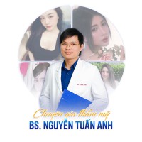 nâng mũi cấu trúc sụn sinh học – dáng mũi đẹp tự nhiên
